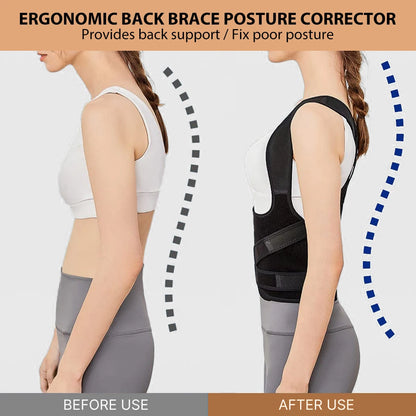 Back Brace and Posture Corrector for Men and Women