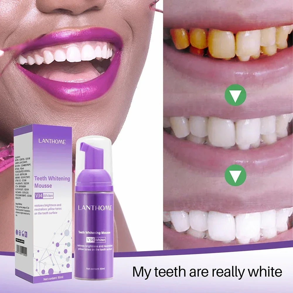 Teeth  Whitening Mousse 50ml